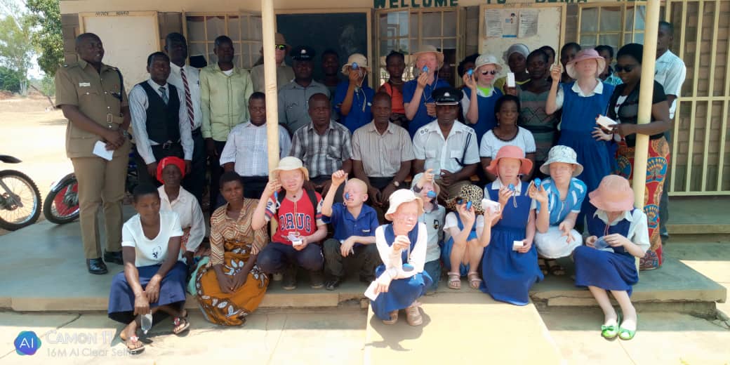 Nkhotakota police distributes  security gadgets to people  with albinism