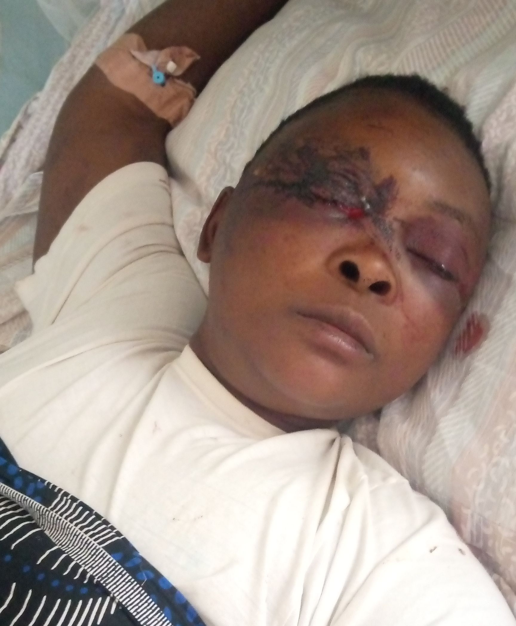 Man Injures Wife in Nkhotakota